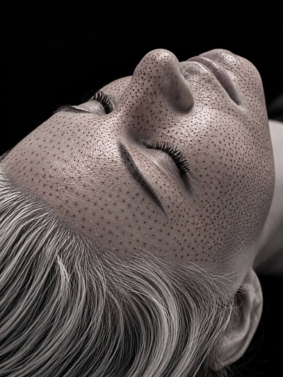 Plasma Fibroblast at Lux Veritae Skin Spa, Scottsdale